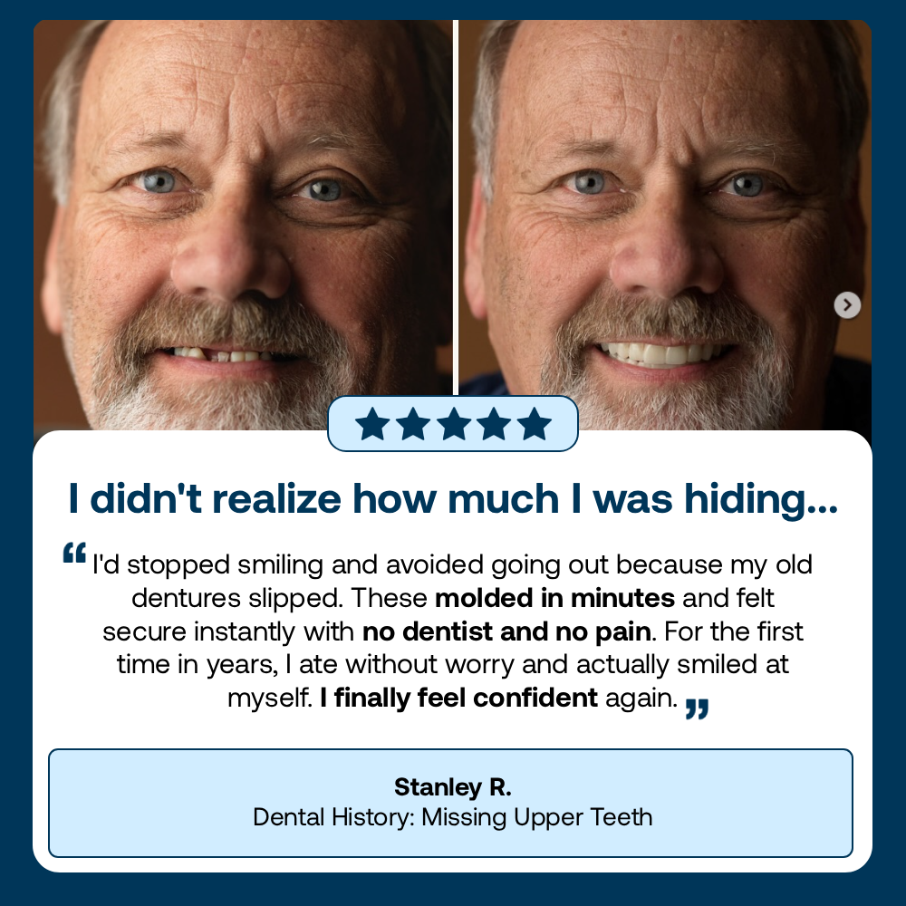 Lab-Quality Self-Fitting Full Custom Dentures