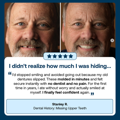 Lab-Quality Self-Fitting Full Custom Dentures