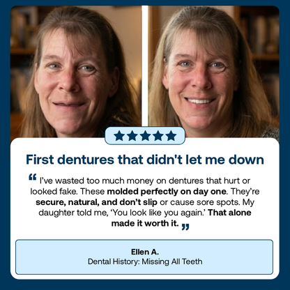 Lab-Quality Self-Fitting Full Custom Dentures