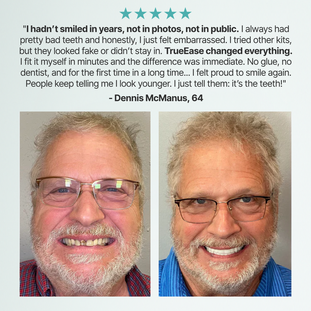 SmileLabs® Custom-Fit Functional Dentures