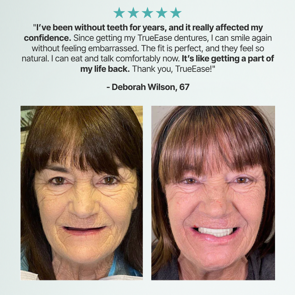 SmileLabs® Custom-Fit Functional Dentures