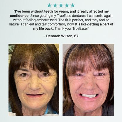 SmileLabs® Custom-Fit Functional Dentures